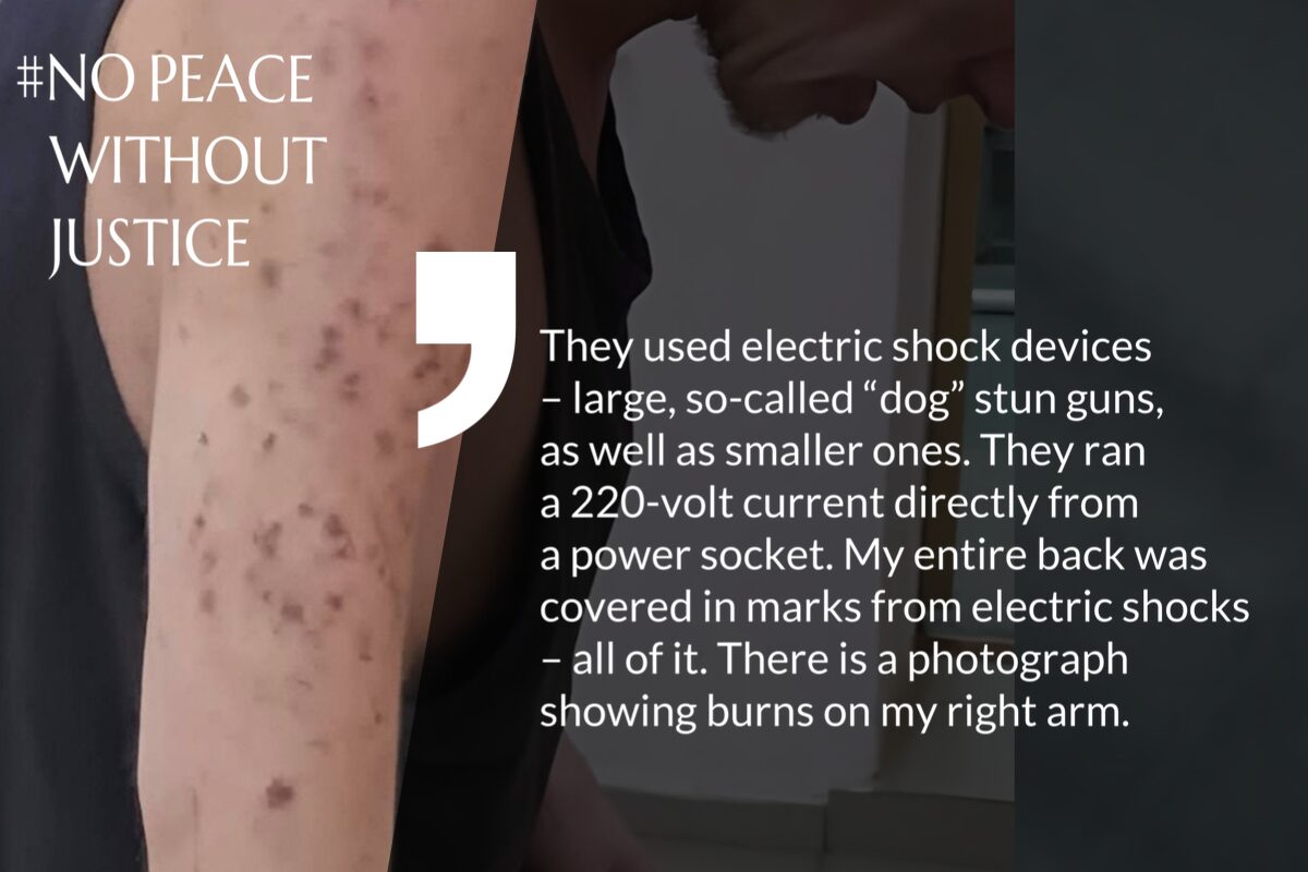 Burn marks on Dmytro Kanupier’s arm caused by electric shocks during captivity